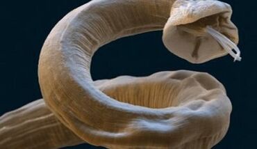 ปรสิต Ascaris ในร่างกายมนุษย์