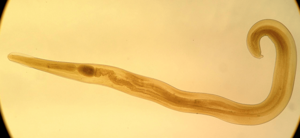 Pinworm เป็นปรสิตที่พบบ่อยในเด็ก